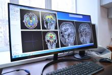 Нейробиологи ТГУ создают «атлас» головного мозга человека